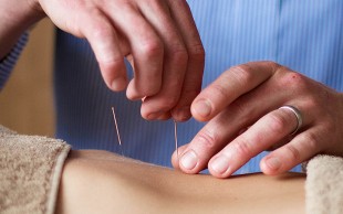 همایش طب سوزنی نوآوران دانش