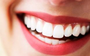 جرم گیری با بروساژ دکتر حورا ندیمی