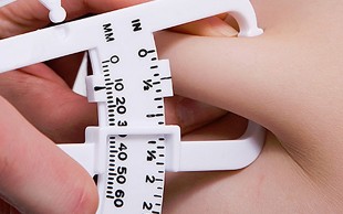 کرایولیپولیز در مطب دکتر مطلبی