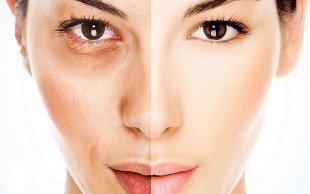 روشن سازی بدن در مطب دکتر سهرابی