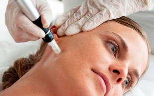 مزوتراپی دکتر مطلبی