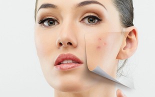 خالبرداری در مطب دکتر شاه حسینی