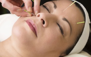 طب سوزنی در ساختمان پزشکان بهنوش