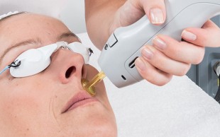 لیزر SHR در کلینیک کهربا