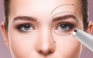 رفع سیاهی دور چشم در کلینیک آلفا