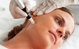 میکرونیدلینگ الی بیوتی سنتر