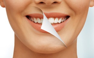 جرم گیری با بروساژ دکتر امیرزاده