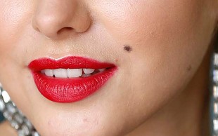 خالبرداری کلینیک هانی بال