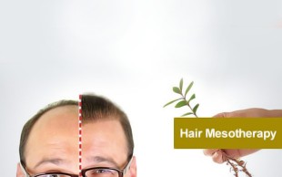 مزوتراپی کلینیک تنا