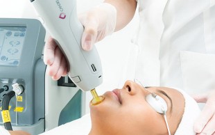 لیزر Elight دکتر حسین تاجیک