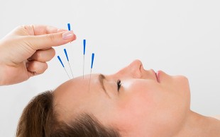 طب سوزنی مطب شرقی