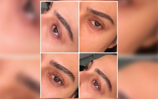 لیفت و لمینت در سالن پرجان