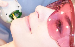 لیزر SHR کلینیک متین