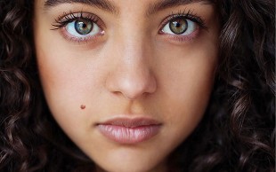 خالبرداری در کلینیک مهر باران