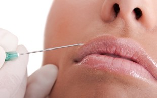 تزریق ژل دکتر یوسفی