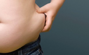 کرایولیپولیز مرکز سیب سرخ میرداماد