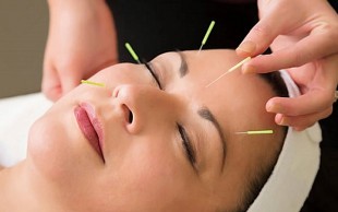 طب سوزنی در سلامتکده سامین نوین طب