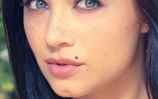 خالبرداری در مطب دکتر داوودآبادی