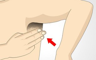 لیزر روشن کننده و جوانسازی پوست در کلینیک آدینا