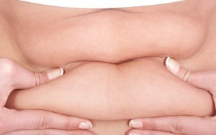 کرایولیپولیز کلینیک دکتر دهباشی