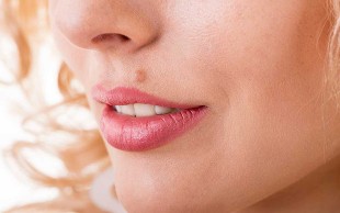 خالبرداری مطب دکتر سالاری