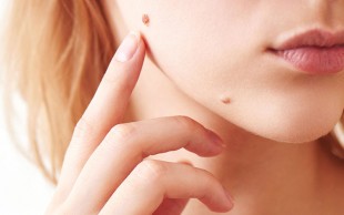 خالبرداری کلینیک یاس