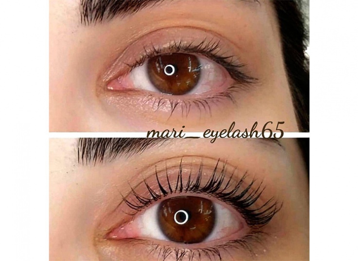 لیفت و لمینت در سالن رز طلایی