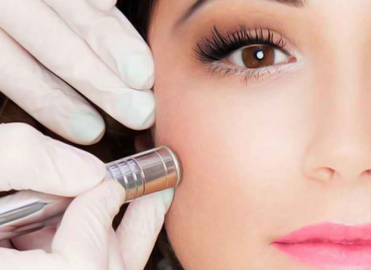 میکرودرم و هیدرودرم کلینیک سفیران