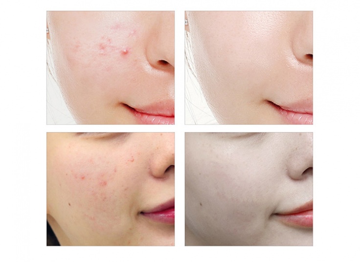 کرم‌ هیدراته‌ آبرسان‌ نیاسین آمید Venzen