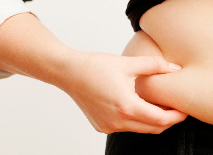 کرایولیپولیز 2016 وکیوم دار در مرکز لاغری عارف