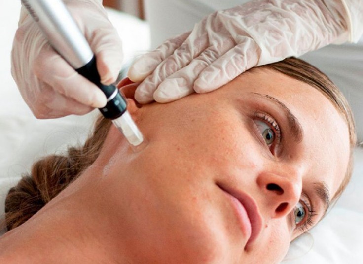 مزوتراپی دکتر مطلبی