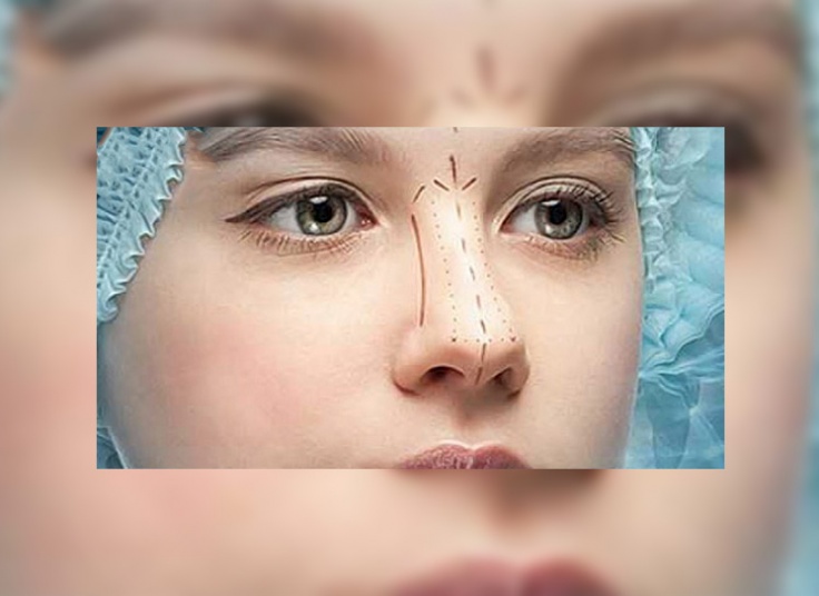 دستگاه پلکسر پلاس در کلینیک ظفر