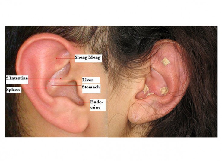 لاغری و جوانسازی در کلینیک آسانا