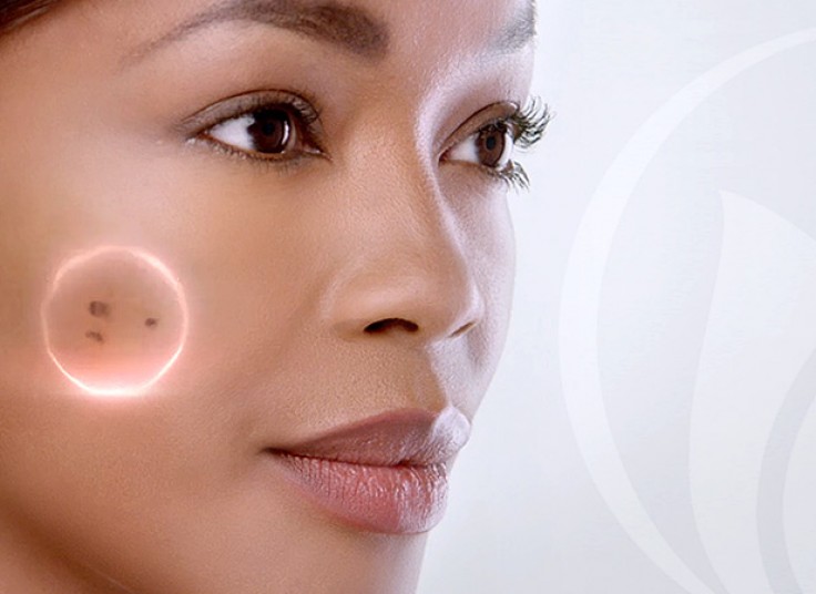 برداشتن خال و لک در مرکز میرداماد