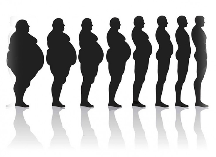 لاغری کویتیشن و RF در کلینیک آلفا