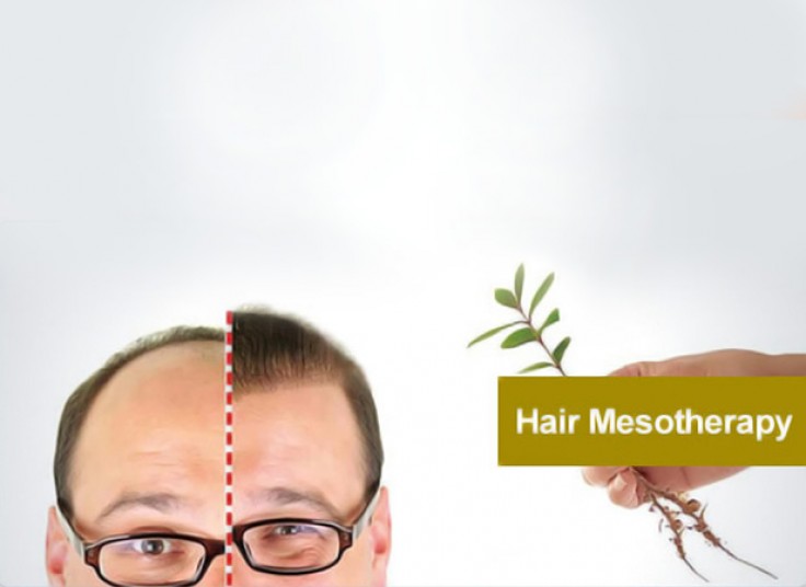 مزوتراپی در مطب دکتر داوودآبادی