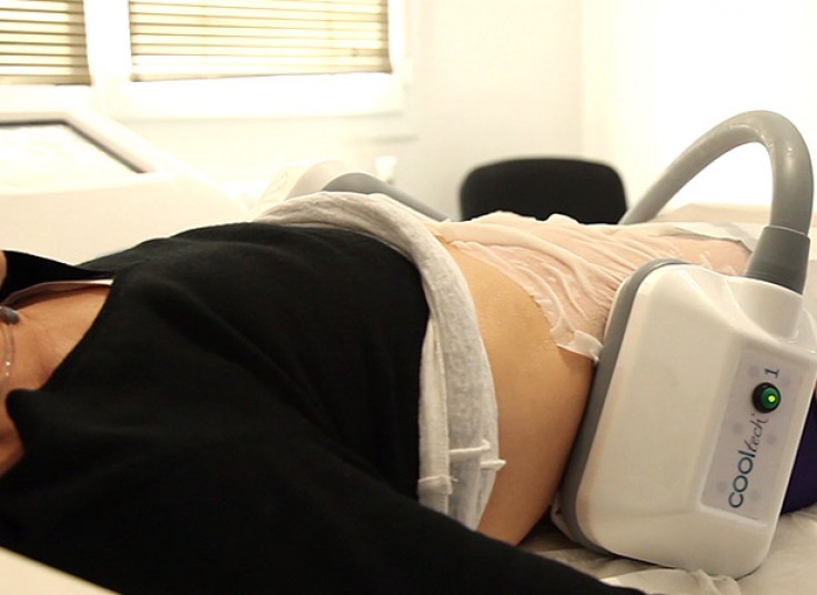 کرایولیپولیز 2016 وکیوم دار در مرکز لاغری عارف