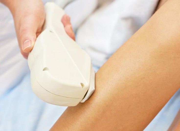 لیزر SHR در مرکز پوست تبسم