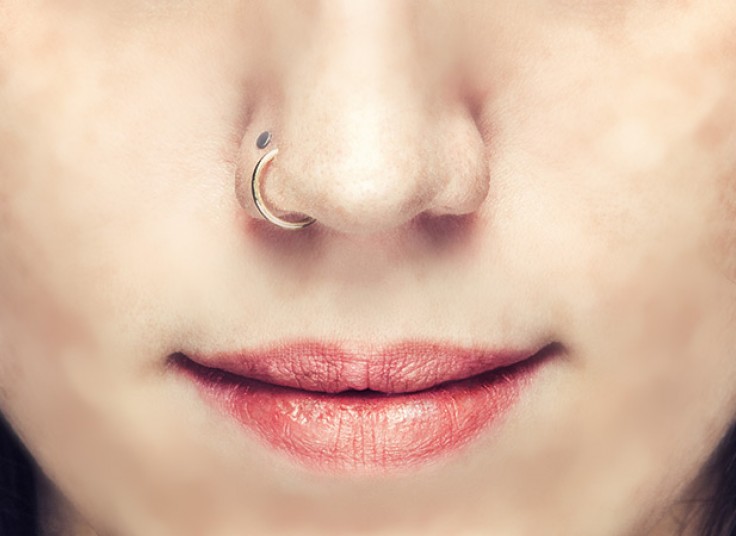 پیرسینگ کلینیک سفیران