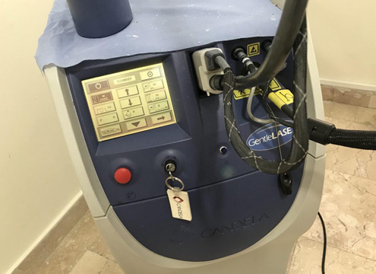 لیزر الکس کندلا نسیم غرب