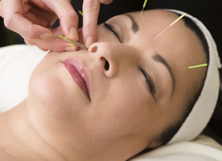 طب سوزنی در ساختمان پزشکان بهنوش