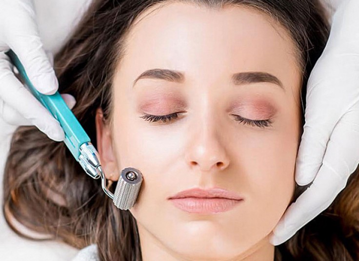 میکرونیدلینگ در کلینیک قنبریان