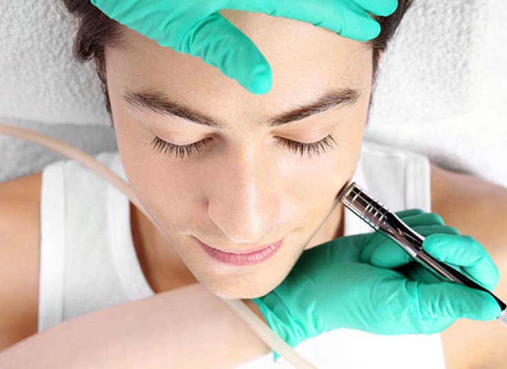 میکرودرم در مطب آوا