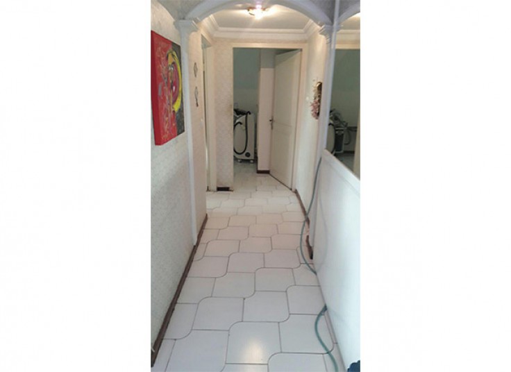 لیزر SHR گروه پزشکان دنیرا