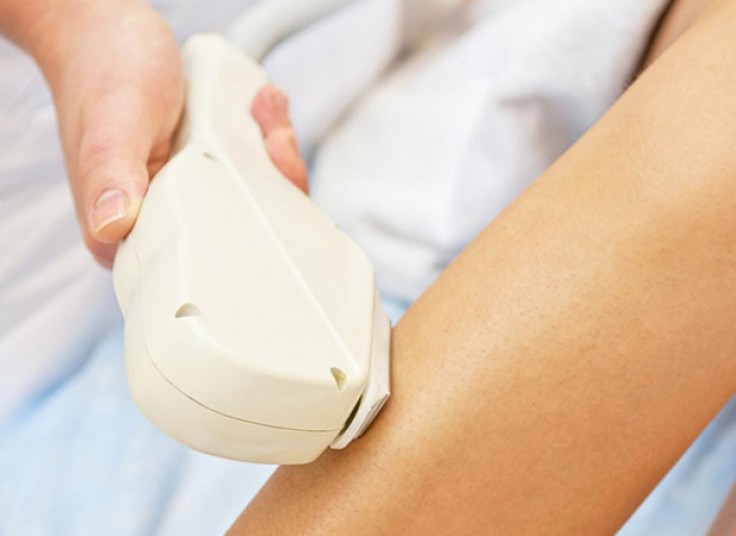 لیزر Elight  در مطب دکتر داوودآبادی