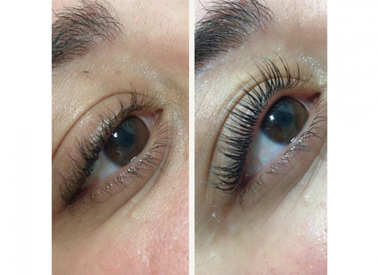 لیفت و لمینت در سالن پرجان