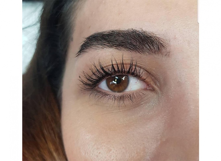 لیفت و لمینت در سالن رز طلایی