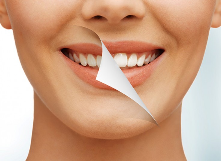 جرم گیری با بروساژ دکتر امیرزاده