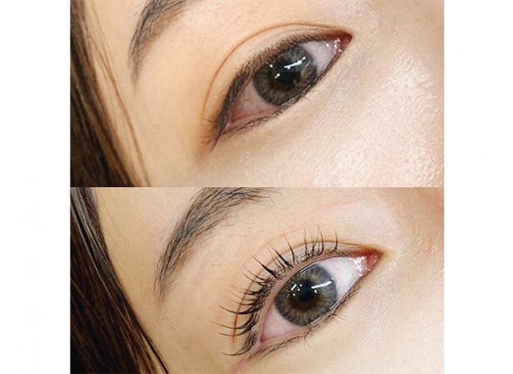 لیفت و لمینت در سالن پرجان