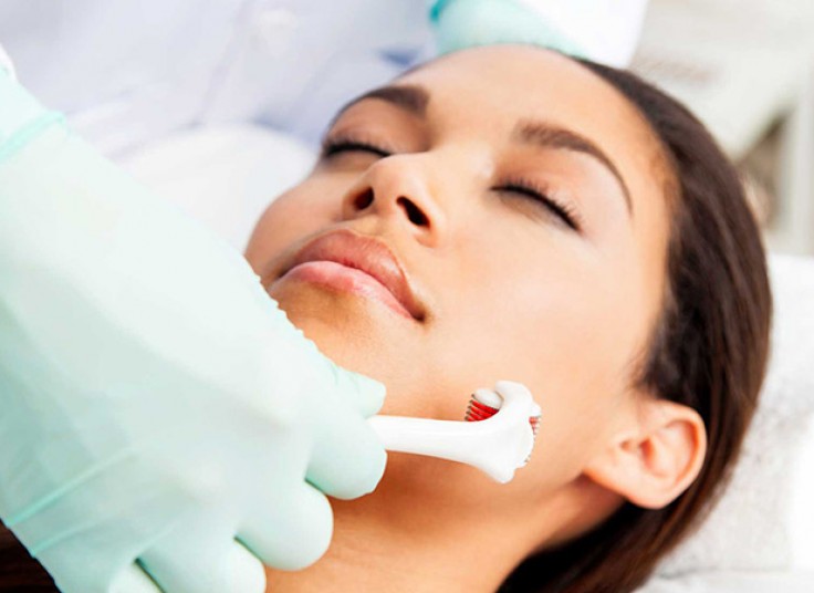 میکرونیدلینگ دکتر ادیب زاده